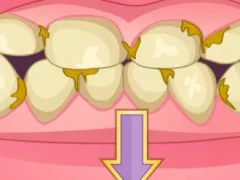 Joc Bad Teeth Makeover on-line