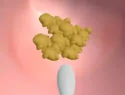 Joc Earwax Clinic on-line