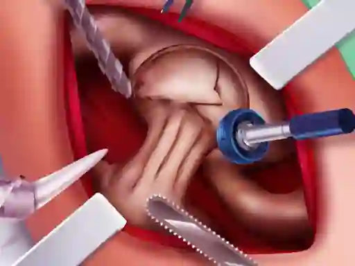Joc Princess Hips Surgery on-line