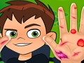 Joc Doctor de mână Ben10 on-line